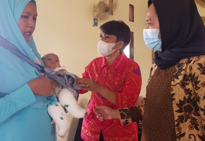 
					Budhi Condrowati Sambangi Balita Pengidap Genu Varum
